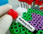 Những điều cần biết về bệnh do virus Marburg