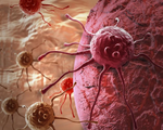 Phát hiện mới về cách hệ miễn dịch nhận biết và tiêu diệt tế bào ung thư