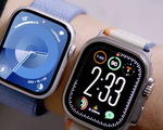 Apple bị cấm bán 2 mẫu đồng hồ thông minh tại Mỹ
