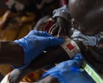 Dịch sởi và tình trạng suy dinh dưỡng khiến hơn 1.200 trẻ em ở Sudan tử vong