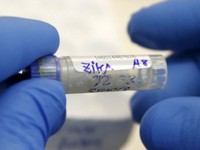 Brazil công bố phương pháp phát hiện virus Zika trong 20 phút