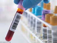 Xét nghiệm máu để phát hiện ung thư trước… 10 năm