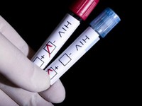 Gần 1 người Nga có kết quả dương tính với HIV