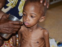 Gần 1 triệu trẻ em  châu Phi bị suy dinh dưỡng