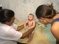 Liệu pháp xoa bóp điều trị trẻ em bị dị tật đầu nhỏ do Zika