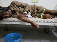 Yemen: 17 người tử vong vì dịch tả mỗi ngày