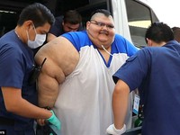 Người đàn ông béo nhất thế giới xuất viện