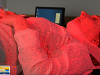 Công nghệ quét 3D giúp xạ trị ung thư vú tại Anh