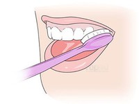 Làm thế nào để loại bỏ các đốm trắng trên răng?