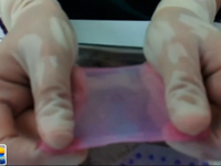 Tây Ban Nha: Tạo ra da người từ máy in 3D