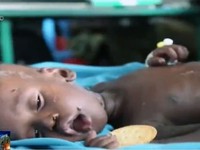 Nam Sudan tuyên bố nạn đói ở nhiều vùng