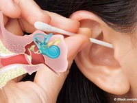Vệ sinh tai thường xuyên gây hại cho sức khỏe con người