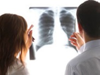 Số người mắc ung thư phổi tăng tại Việt Nam