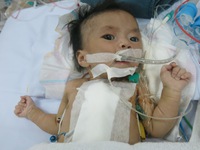 Xót xa bệnh nhi 2 tháng tuổi sống chung với máy thở oxi