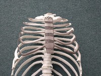 Ca ghép xương ngực nhân tạo bằng công nghệ in 3D đầu tiên tại Hàn Quốc