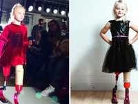 Cô bé 7 tuổi khuyết tật bẩm sinh gây chấn động làng thời trang thế giới