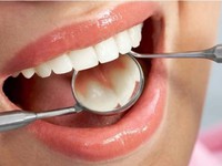 Xylitol tự nhiên giúp ngừa sâu răng