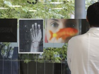 Triển lãm ảnh chụp X-quang về vấn nạn bạo lực gia đình tại Italy