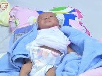 Hành trình cứu sống bé gái sinh non chỉ nặng 1kg bị tim bẩm sinh