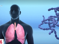 WHO: Virus viêm phổi cấp sẽ còn lan rộng