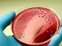 Mỹ điều tra đợt bùng phát các ca nhiễm khuẩn Salmonella Newport