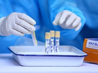 Vì sao xét nghiệm PCR của bệnh nhân COVID-19 đến lần 3 mới dương tính?