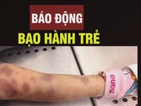 Vụ bé gái 8 tuổi bị bạo hành: Xin đừng lặng im!