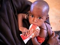 Somalia: Hơn 0,5 triệu trẻ em dưới 5 tuổi đối mặt nguy cơ suy dinh dưỡng cấp tính nghiêm trọng