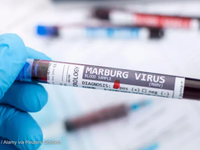 WHO họp khẩn vì ổ dịch sốt xuất huyết do virus Marburg