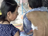 Người phụ nữ bị chồng "hờ" ở An Giang bạo hành dã man