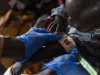 Dịch sởi và tình trạng suy dinh dưỡng khiến hơn 1.200 trẻ em ở Sudan tử vong
