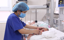 Phẫu thuật nội soi tắc tá tràng bẩm sinh cho bé trai sơ sinh