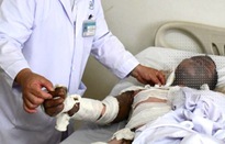 Một công nhân bị điện giật gây bỏng nặng phải nhập viện cấp cứu