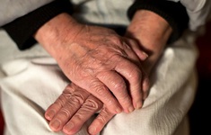 Thuốc lecanemab làm chậm suy giảm nhận thức với bệnh nhân Alzheimer