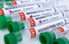 Châu Phi cần bộ xét nghiệm, vaccine trong bối cảnh bệnh đậu mùa khỉ lây lan