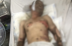 Đồng Nai: Cấp cứu một công nhân bị bỏng nặng do cháy công ty ở huyện Trảng Bom