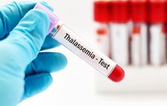 Tăng cường phổ cập thông tin về bệnh Thalassemia để nâng cao chất lượng giống nòi Việt