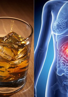 Rượu - Nguyên nhân dẫn tới hơn 700.000 ca mắc ung thư mới