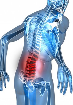Điều trị hiệu quả chứng đau lưng bằng y học cổ truyền