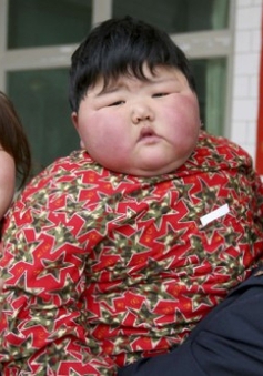 Gia tăng tỷ lệ béo phì ở nông thôn Trung Quốc