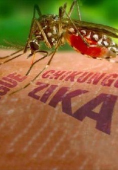 Chưa có mối liên hệ giữa virus Zika và bệnh đầu nhỏ