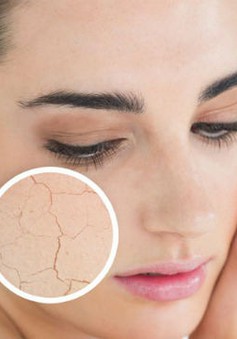 8 cách chăm sóc da trong mùa hanh khô