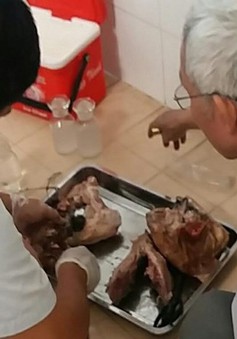 Bình Phước: Phát hiện ổ bệnh với 108 người nhiễm sán dây lợn