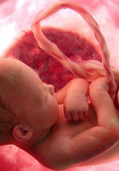 Thêm một thai nhi tử vong, Bộ Y tế tiếp tục yêu cầu làm rõ nguyên nhân