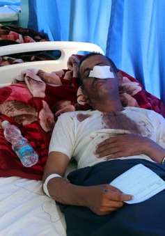 Yemen: Dội bom trúng đám cưới, gần 40 người thiệt mạng
