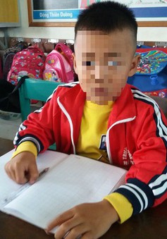 Quảng Bình: Học sinh lớp 1 bị cô giáo tát chảy máu tai, nghi chấn động sọ não