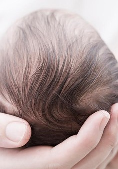 Rụng tóc vành khăn ở trẻ sơ sinh có phải là bệnh lý? Điều trị ra sao?