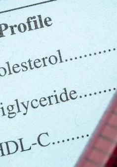 Thuốc giảm Cholesterol dạng viên – lựa chọn mới cho những người sử dụng nhóm thuốc Statin