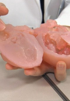 Công nghệ in 3D phát triển trong lĩnh vực y tế tại Hàn Quốc