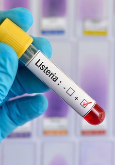 Tây Ban Nha ban hành cảnh báo quốc tế về trường hợp nhiễm khuẩn listeria
